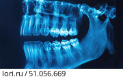 panoramic x-ray of tooth scan ai generated. Стоковое AI-изображение, AI-художник Vectorwin / Фотобанк Лори
