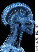 X-ray image of human cervical spine and head skull. The sella turcica looks normal. Medical image concept. Black background. Стоковое AI-изображение, AI-художник Ирина Михайличенко / Фотобанк Лори