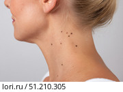 Close-up of small moles on fair-skinned woman's neck. Стоковое AI-изображение, AI-художник Евгения Пархоменко / Фотобанк Лори