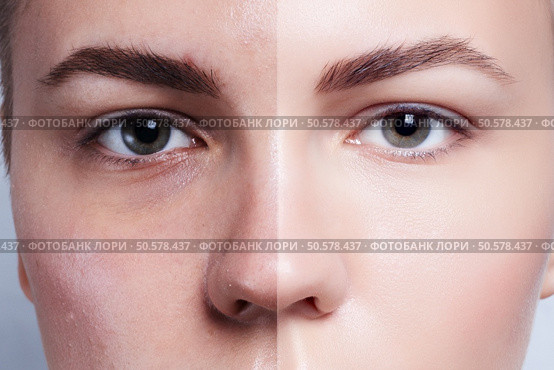 Before and after cosmetic operation. Young pretty woman portrait, isolated on a white background. Before and after cosmetic or plastic procedure, anti-age therapy. Before and after cosmetic operation. Young pretty woman portrait. Стоковое фото, агентство Ingram Publishing / Фотобанк Лори