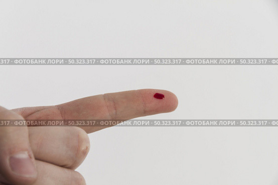 bleeding finger. Стоковое фото, агентство Ingram Publishing / Фотобанк Лори