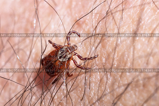 Blood-sucking mite on a human skin macro. Стоковое фото, фотограф Георгий Дзюра / Фотобанк Лори
