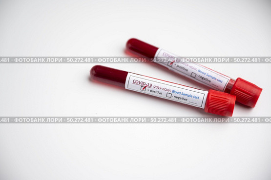 Blood test samples for presence of coronavirus (COVID-19) tube containing a blood sample that has tested positive for coronavirus. Стоковое фото, агентство Ingram Publishing / Фотобанк Лори