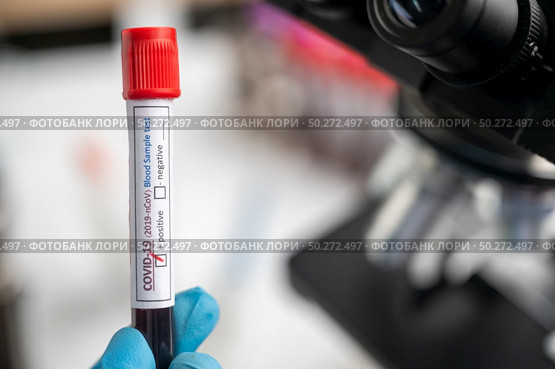 Blood test samples for presence of coronavirus (COVID-19) tube containing a blood sample that has tested positive for coronavirus. Стоковое фото, агентство Ingram Publishing / Фотобанк Лори