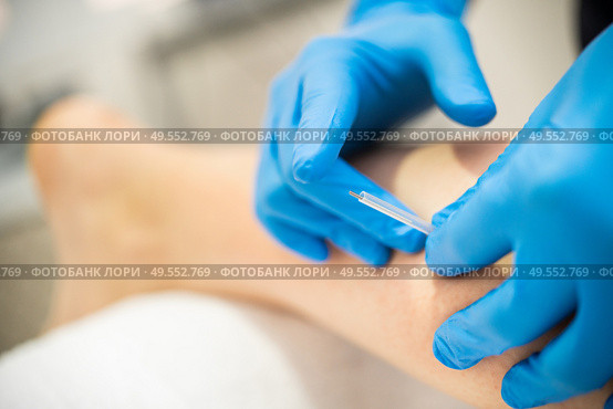Close-up of a needle and hands of physiotherapist doing a dry needling in a physiotherapy center.. Hands of physiotherapist doing a dry needling. Стоковое фото, агентство Ingram Publishing / Фотобанк Лори