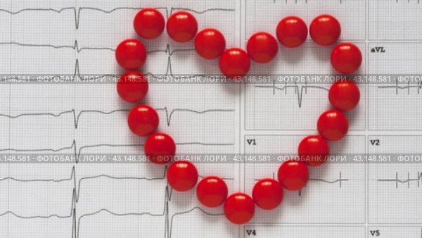 Concept of treatment and prevention of cardiovascular diseases. Top view of red pills in the shape of a heart on the background of a cardiogram. Flat lay, close-up, copy space, mock up. Стоковое видео, видеограф Виктория Катьянова / Фотобанк Лори