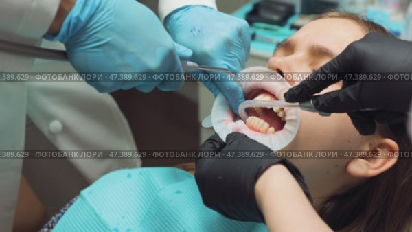 Dental team rinsing and preparing patients teeth for aligner bonding in orthodontic procedure. Стоковое видео, видеограф Дмитрий Наумов / Фотобанк Лори