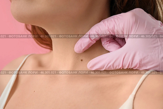 Dermatologist examining mole on young woman's neck against pink background, closeup. Стоковое фото, фотограф Pixel_shot / Фотобанк Лори