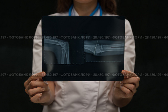 Doctor examining a arm bones radiography. Стоковое фото, фотограф Kirill Kedrinskiy / Ingram Publishing / Фотобанк Лори