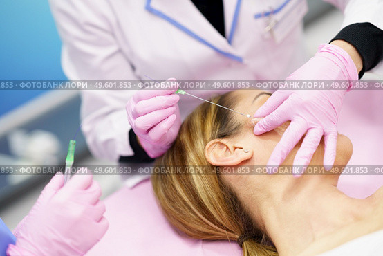 Doctor injecting PDO suture treatment threads into the face of a middle-aged woman.. Doctor injecting PDO suture treatment threads into the face of a woman. Стоковое фото, агентство Ingram Publishing / Фотобанк Лори
