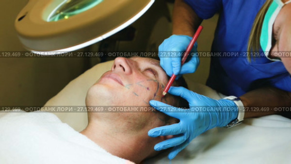 Female doctor is preparing patient for procedure with using marker in estetic clinic. Стоковое видео, видеограф Яков Филимонов / Фотобанк Лори