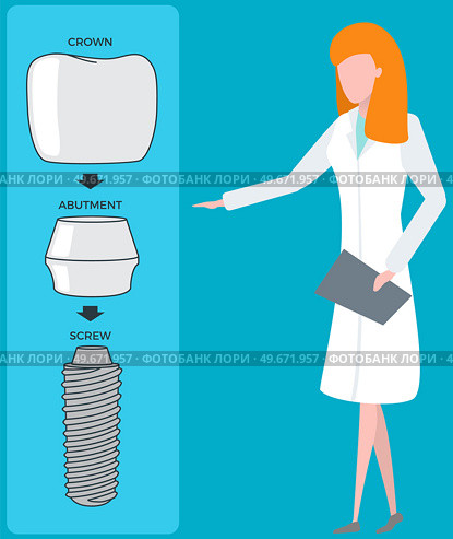 Female doctor talking about dental prosthesis structure. Implantation dentistry, stomatology. Tooth care, treatment. Dental implant creation scheme. Sequence of connection of screw, abutment and crown. Female doctor talking about prosthesis structure. Dentist works with dental implant creation scheme. Стоковая иллюстрация, агентство Ingram Publishing / Фотобанк Лори