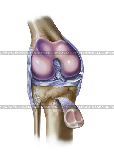 Front view of knee showing torn medial collateral ligament. Стоковое фото, фотограф Elise Walmsley-MacWha/Stocktrek Images / ТАСС / Фотобанк Лори