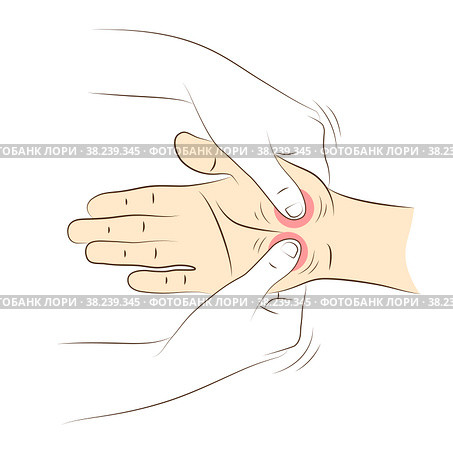 Hand massage, close-up. Physiotherapist presses special points on female palm to relieve headaches and other pains. Health and wellness acupressure manipulations. Alternative medicine, reflexology. Массаж рук, крупный план. Физиотерапевт нажимает на специальные точки на женской ладони, чтобы облегчить головную и другие боли. Акупрессурные манипуляции для здоровья и хорошего самочувствия. Альтернативная медицина, рефлексотерапия. Стоковая иллюстрация, иллюстратор Dmitry Domashenko / Фотобанк Лори