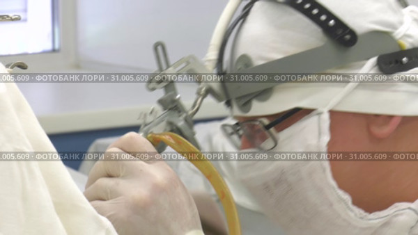 Хирургия. Доктор проводит операцию. Surgery. The doctor performs surgery. (2019 год). Редакционное видео, видеограф Евгений Романов / Фотобанк Лори