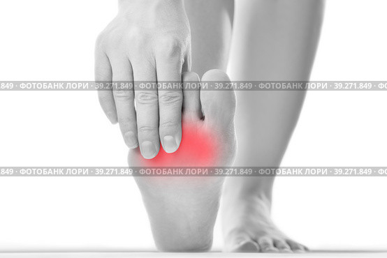 Joint diseases, hallux valgus, plantar fasciitis, heel spur, woman's leg hurts, pain in the foot, massage of female feet isolated on white background. Стоковое фото, фотограф Станислав Тарко / Фотобанк Лори