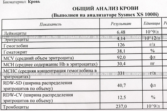 Листок с общим анализом крови (2018 год). Редакционное фото, фотограф Игорь Низов / Фотобанк Лори
