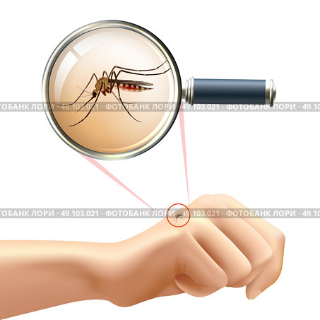 Mosquito on hand. Realistic composition with human hand and mosquito in magnifying glass zoom vector illustration. Стоковая иллюстрация, агентство Ingram Publishing / Фотобанк Лори