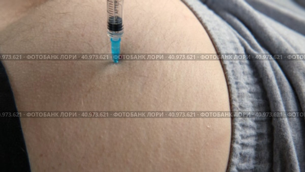Needle injecting into the muscle. Nurse doing a trigger point injection in patient back. Close up doctor makes an shot therapy. Alternative pain treatment. Covid-19, pox, MPOX, flu virus vaccine. Стоковое видео, видеограф Марина Демидюк / Фотобанк Лори