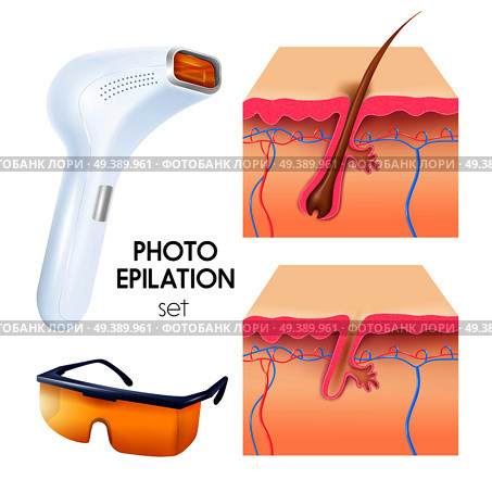 Photo epilation realistic set with epilator protective goggles and cross section of skin layers scheme vector illustration . Photo Epilation Realistic Set. Стоковая иллюстрация, агентство Ingram Publishing / Фотобанк Лори