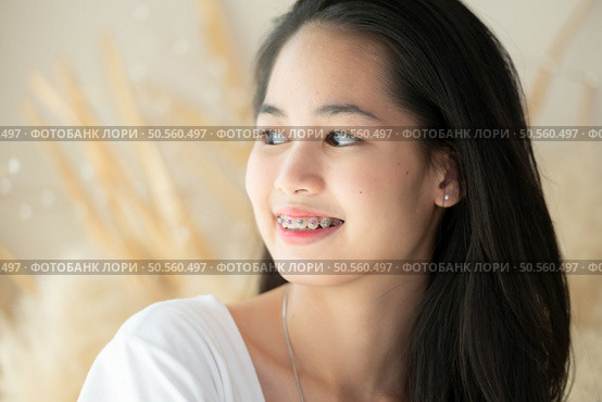 Portrait of a young asian woman with braces on her teeth. Стоковое фото, агентство Ingram Publishing / Фотобанк Лори