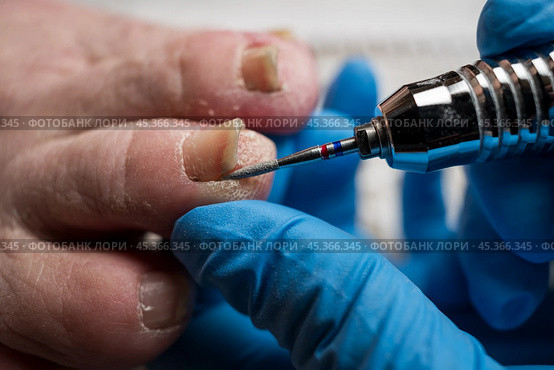 Professional hardware pedicure, ingrown toenail, elderly woman with cracked skin on her foot at a podiatrist's appointment, chiropody and podology concept. Стоковое фото, фотограф Станислав Тарко / Фотобанк Лори