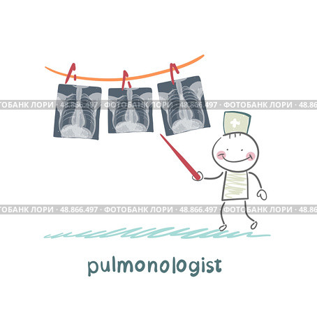 pulmonologist shows an X-ray of human lung. Стоковая иллюстрация, агентство Ingram Publishing / Фотобанк Лори