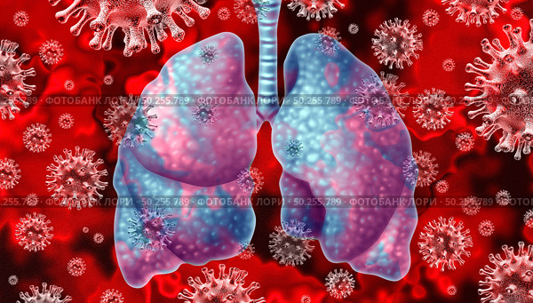Respiratory virus and coronavirus outbreak and coronaviruses influenza background as dangerous flu strain cases  or SARS as a pandemic medical health risk concept with infected human lungs as a 3D render. Стоковое фото, агентство Ingram Publishing / Фотобанк Лори