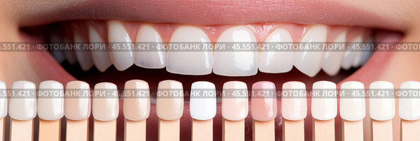 Smiling woman mouth with teeth color samples, closeup. Dental veneers. Choosing a shade of dental veneers for bleaching. Teeth whitening. Cosmetic Dentistry, dental treatment. Veneers installation. Стоковое AI-изображение, AI-художник Марина Демидюк / Фотобанк Лори