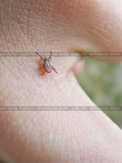 Tick on skin. Стоковое фото, фотограф Andreas Altenburger / PantherMedia / Фотобанк Лори