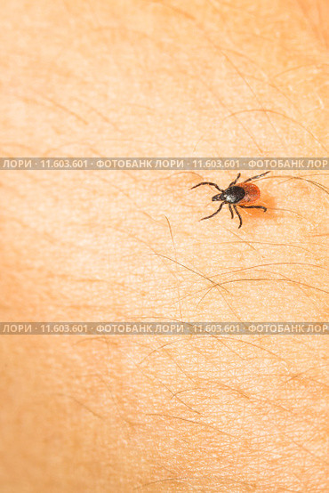 Tick - parasitic arachnid blood-sucking carrier of various diseases. Стоковое фото, фотограф Viktor Cap / Smarterpix / Фотобанк Лори