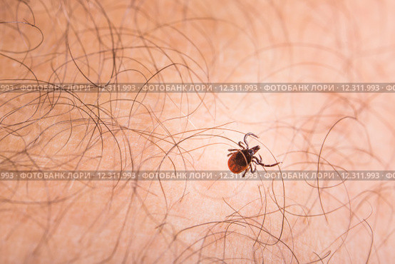 Tick - parasitic arachnid blood-sucking carrier of various diseases. Стоковое фото, фотограф Viktor Cap / Smarterpix / Фотобанк Лори