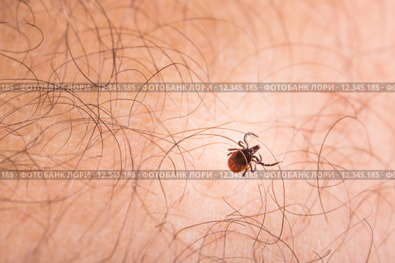 Tick - parasitic arachnid blood-sucking carrier of various diseases. Стоковое фото, фотограф Viktor Cap / Smarterpix / Фотобанк Лори