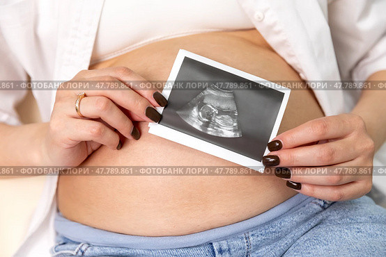 Ultrasound picture pregnant baby photo. Woman holding ultrasound pregnancy sonogram picture of unborn baby inside her big belly. Concept of pregnancy, maternity, expectation for baby birth. Стоковое фото, фотограф Ирина Михайличенко / Фотобанк Лори