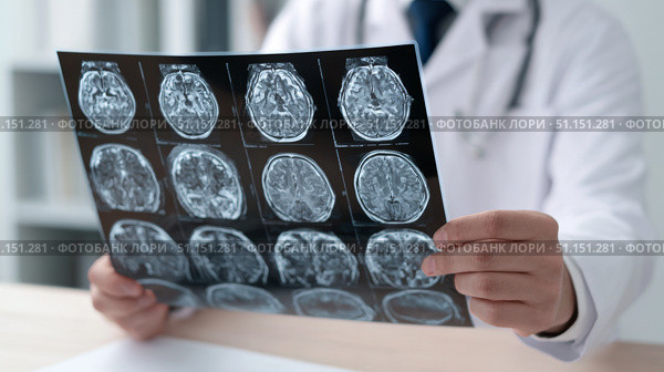 Врач держит в руках рентгеновский снимок мозга. The doctor holds an X-ray of the brain. Стоковое AI-изображение, AI-художник Смирнова Светлана / Фотобанк Лори