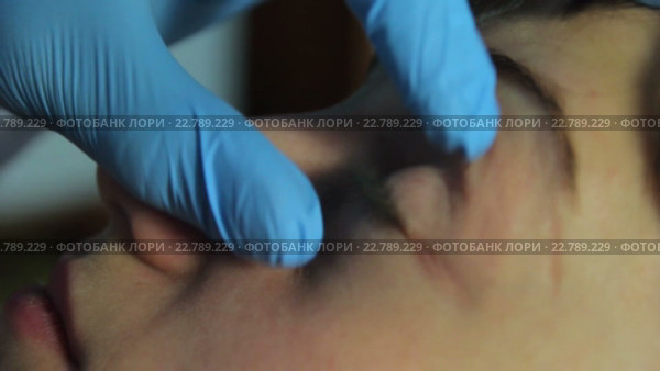 Врач закапывает капли в глаза пациентке. Стоковое видео, видеограф Video Kot / Фотобанк Лори