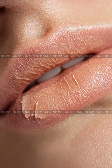 Woman showing dry and chapped lips needing moisturizer. Стоковое AI-изображение, AI-художник Юрий Поздников / Фотобанк Лори