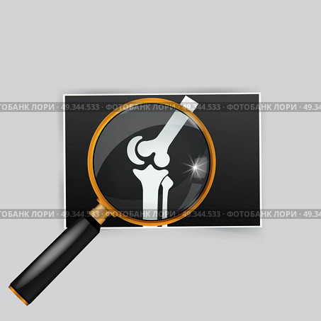 X-ray of the knee magnifying glass search. Стоковая иллюстрация, агентство Ingram Publishing / Фотобанк Лори