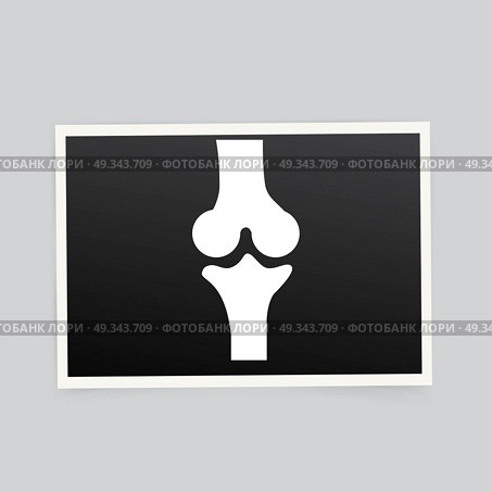 X-ray of the knee. Vector illustration. Стоковая иллюстрация, агентство Ingram Publishing / Фотобанк Лори