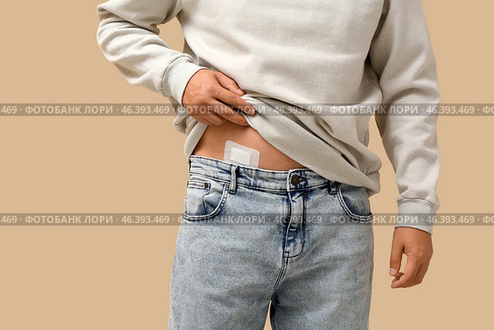 Young man with medical patch after appendix surgery on beige background, closeup. Стоковое фото, фотограф Pixel_shot / Фотобанк Лори