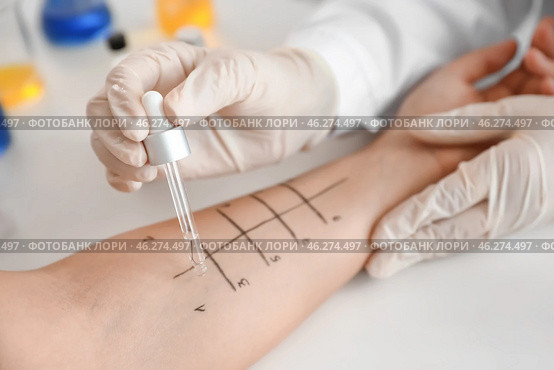 Young woman undergoing procedure of allergen skin tests in clinic. Стоковое фото, фотограф Pixel_shot / Фотобанк Лори